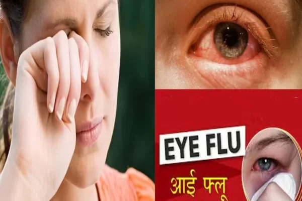 देश में आई फ्लू का कहर, जानिए कैसे बचें